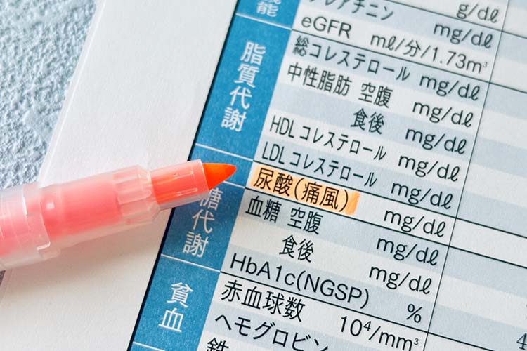 高尿酸血症